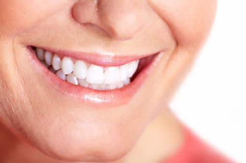 List of DIY Teeth Whitening Hacks