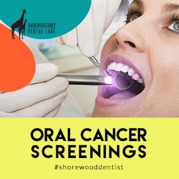 screenings for preventing oral cancer