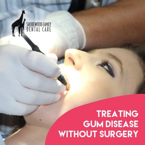 Treating Gum Disease without Surgery