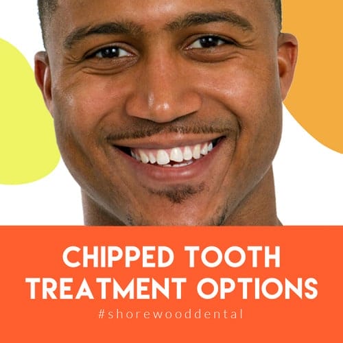 crowns on teeth for a chipped tooth
