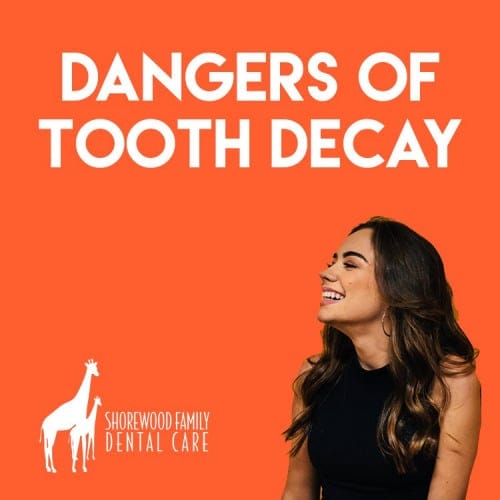 Risks and Dangers of Avoiding Cavities and Not Taking Care of Them