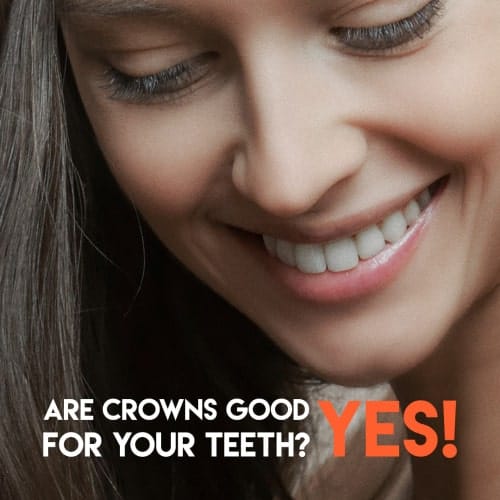 Are Dental Crowns Good For Your Teeth