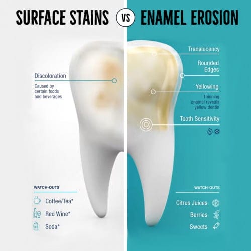 teeth staining habits causing surface stains and enamel erosion