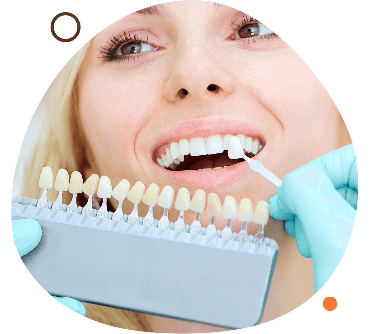 implants dentures available at shorewood family dental care