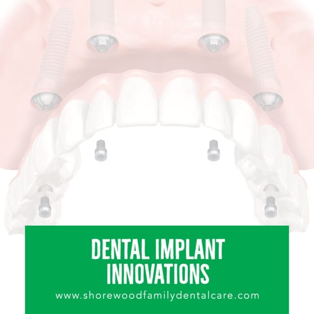 dental implant trends and innovations