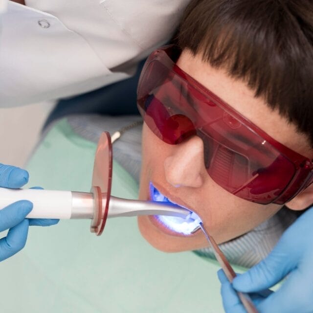 how long do dental fillings last