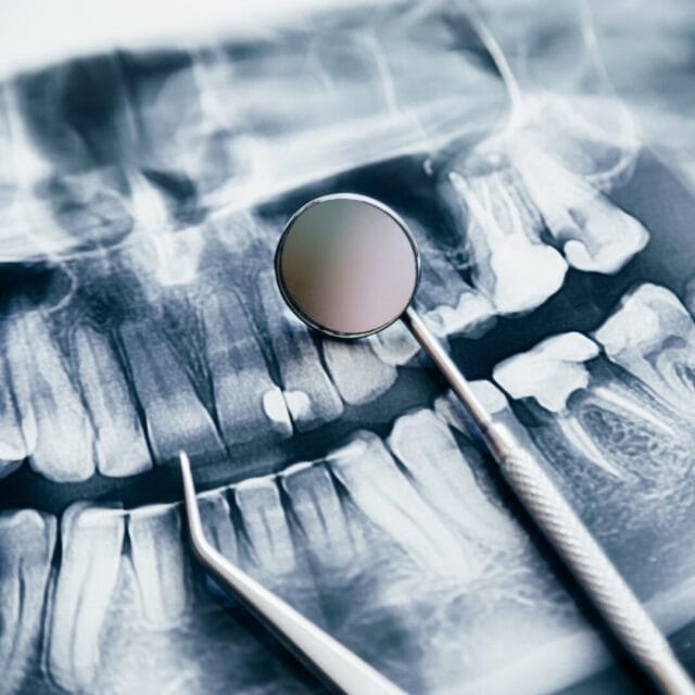 the effects of jaw health while on medications for osteperosis